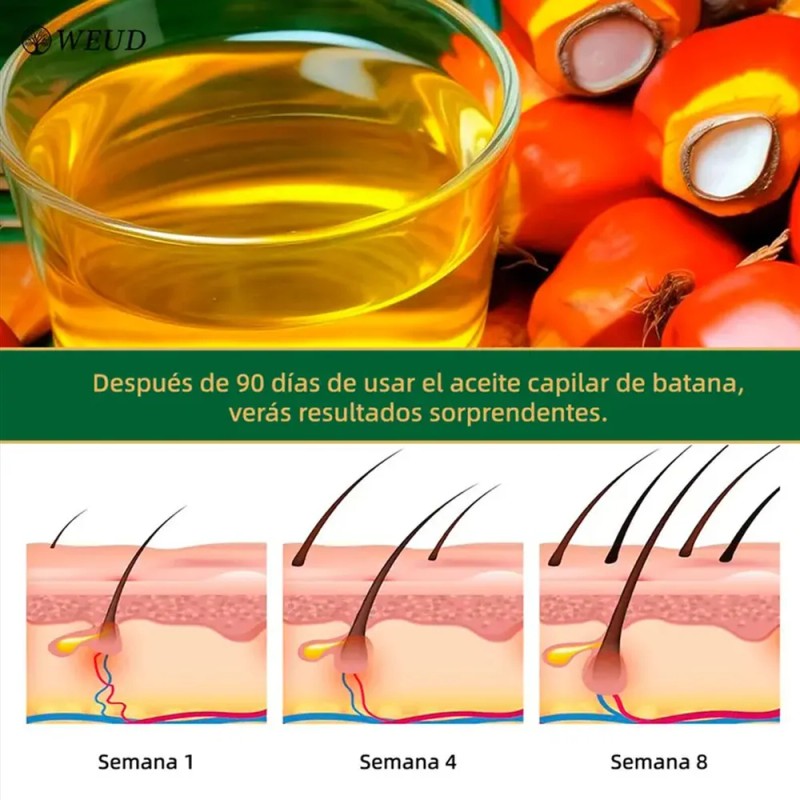 10pc Weud Battana Aceite Capilar Nutrir Para Cuero Cabelludo