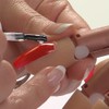 Nail Trainer ® Refit Pack 4 Fingers 1 Thumb