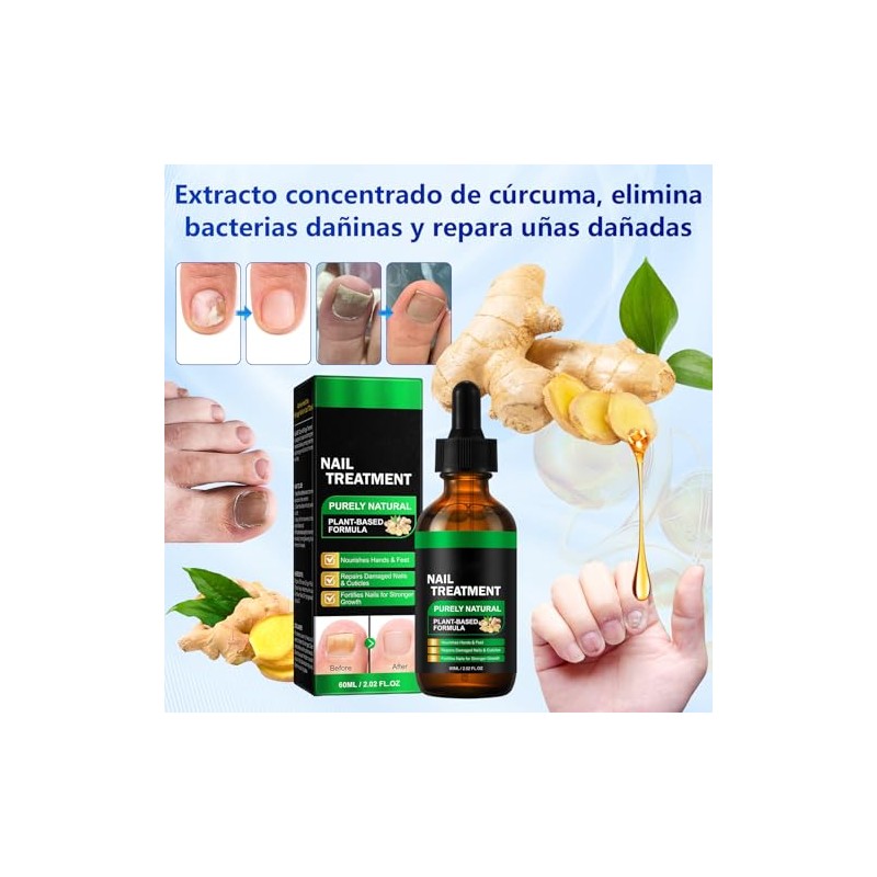 Parches Reparadores de Uñas+Tratamiento de Uñas con Esencia de Jengibre