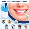 Teeth Whitening Kit, Teeth Whitening Kit with LED Light, Mouth