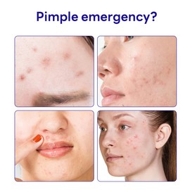 Mediheal Derma Clear Madecassoside Blemish Spot Patch (44 Counts) - Acne Spot Protection, Spot Fast Healing with Madecassoside & Niacinamide