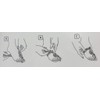 Russka Hallux Valgus Night Splint for Correction of Big Toe