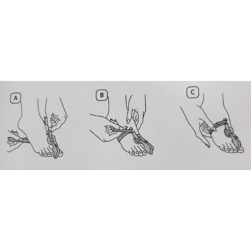Russka Hallux Valgus Night Splint for Correction of Big Toe