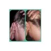 Shampoo Kanin Dermatológica con Alquitrán de Hulla para Psoriasis y