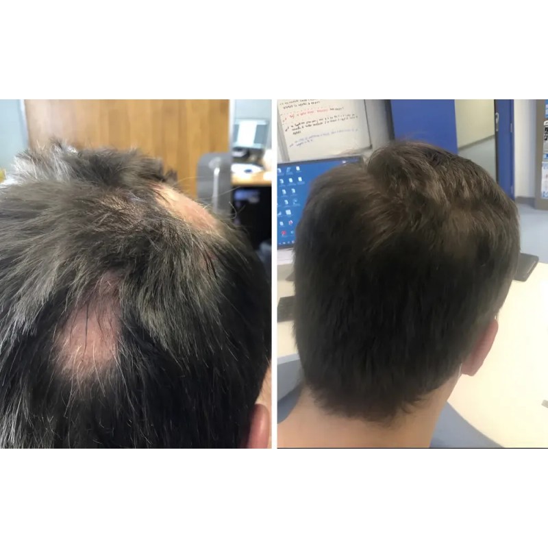 Shampoo Reviving Farmasi Caida Cabello