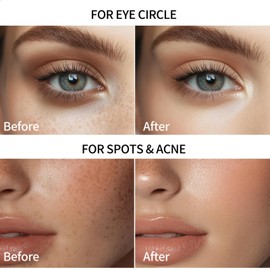 6-in-1 Concealer Palette,Concealer Full Coverage Palette,Creamy Concea/ler Cream,Under Eye Conce/aler,Conce/aler for Mature Skin,Colour Corrector for Face,Creamy Blendable Colour Correcting Pal/ette