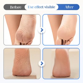 Crema Hidratante Y Antigrietas Para Pies Con 60% De Urea, 2026. Crema Para Pies Mejorada Que Hidrata Y Alivia Las Grietas Y La Sequedad. Repara E Hidrata Los Pies Secos Y Agrietados (1)