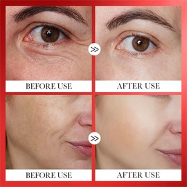 Anti Wrinkle Pill Serum, Anti-Wrinkle Essential Oil, Firmness/Lifting/Anti Wrinkle/Smoothing/Skin Beauty, Anti-Aging Pill Serum 5 Benefits for Beautiful Skin (Anti-Wrinkle Pill)