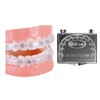 Comfort Covers for Braces - Protector bucal ortodóntico, protector de