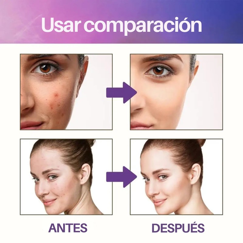 Parches Cubre Acné Estrellas