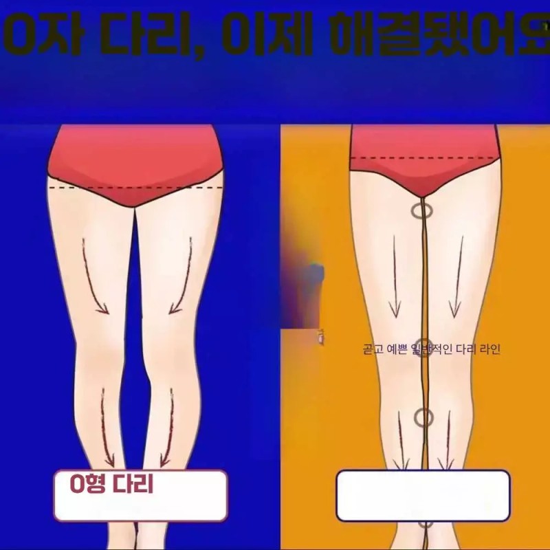 Trendbooth 트렌드부스 오자다리교정기 오자다리 교정기 휜다리 [블랙 XXS 60-70cm] Trendboos