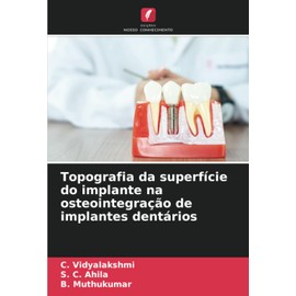 Topografia da superfície do implante na osteointegração de implantes dentários