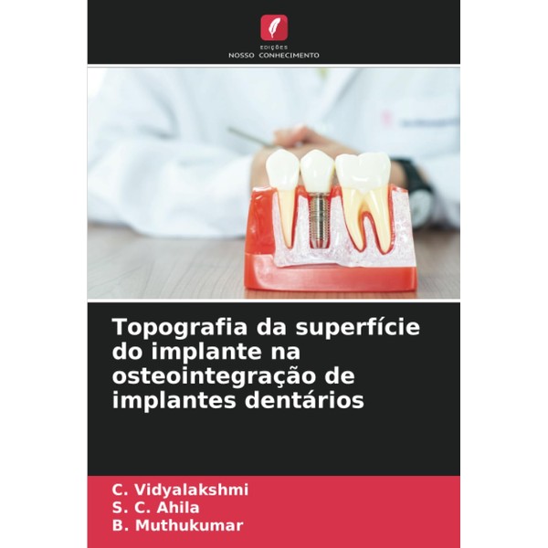 Topografia da superfície do implante na osteointegração de implantes dentários