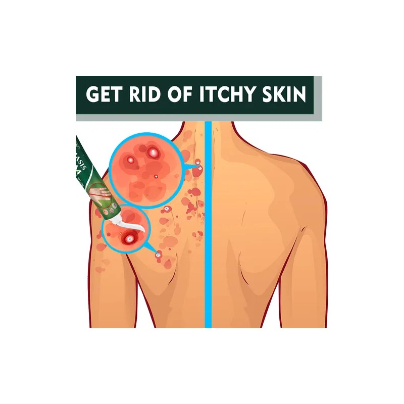 Gn Crema For El Cuidado De La Piel Hidratante Uso