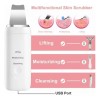 Limpiador Facial Ultrasonico Skin Scrubber Ultrasonic Facial Skin Scrubber Exfoliator
