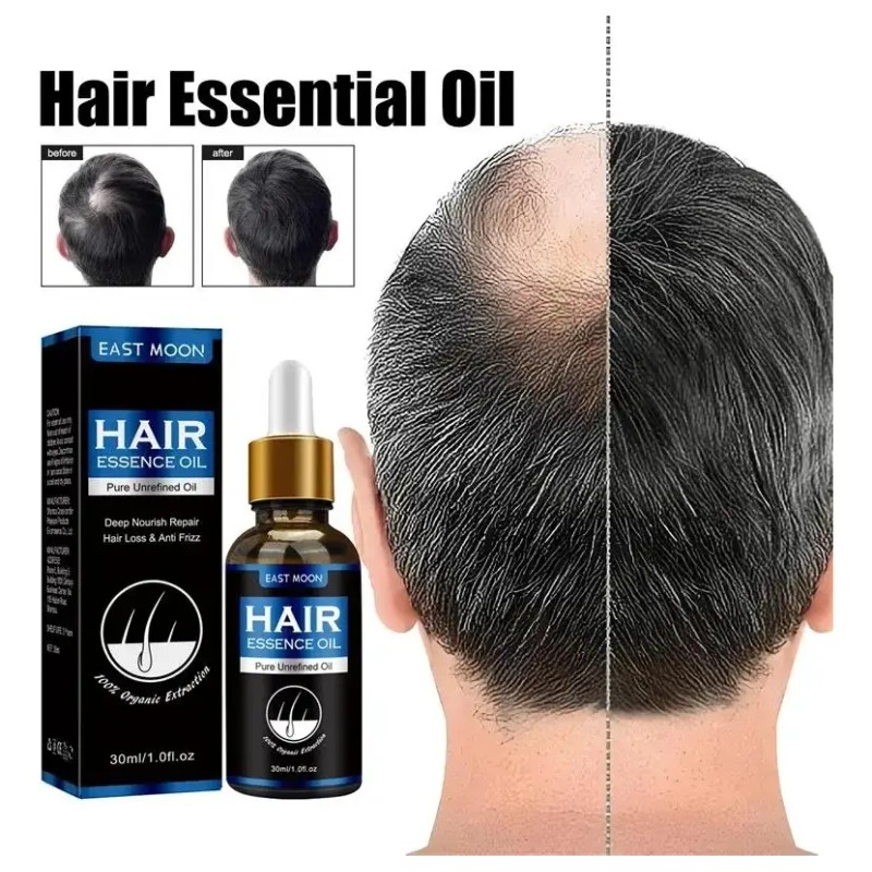 Aceite Crecimiento Cabello