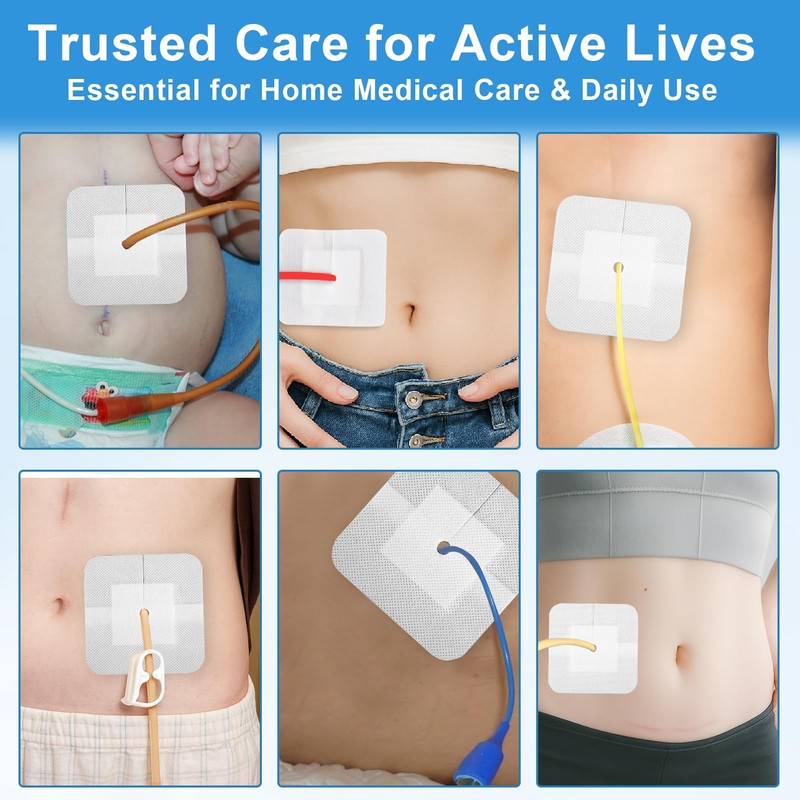 20-Pack Split Drain Adhesive Bandages for PD Catheter & Feeding