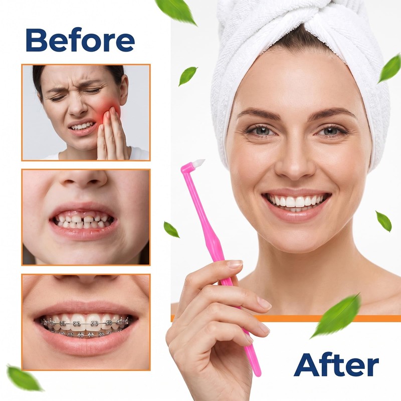 8Pcs Soft End Tuft Toothbrush Orthodontic Tapered Brush Detail Cleaning