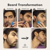 Aberlite ClearShaper 3.0 - Beard Shaper Kit w/Two Barber Pencils