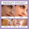 2pcs Crema Epiglow Melanex Advanced Anti-hiperpigmentación