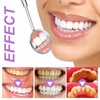 Purple Bright White Teeth Strips