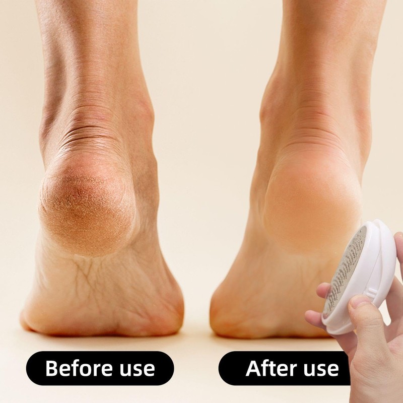 3-Piece Egg-Shaped Foot Files, Exfoliating Foot Rub, Manual Foot Scrub,