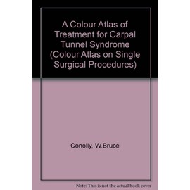 A Colour Atlas of Treatment of Carpal Tunnel Syndrome (Single Surgical Procedures)