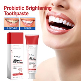 Sp-6 Zahnpasta, 120 G Probiotics Bright White Zahnpasta Toothpaste Sp-6 Brightening Ultra Whitening Toothpaste Sp-6, Deep Cleaning Oral Care Toothpaste, Frischer Atem (Rot)