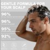Shampoo De Cebolla Generic Para Crecimiento Capilar