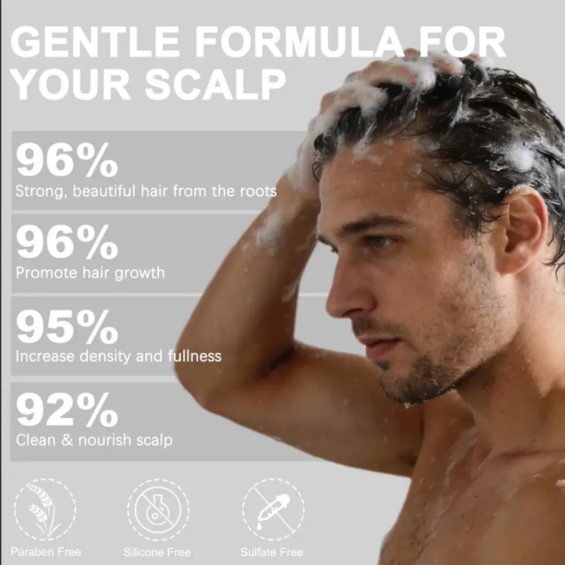 Shampoo De Cebolla Generic Para Crecimiento Capilar