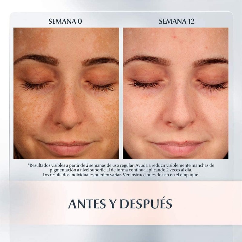Lápiz corrector Anti Manchas Anti Pigment Spot Corrector, 5ml Paquete