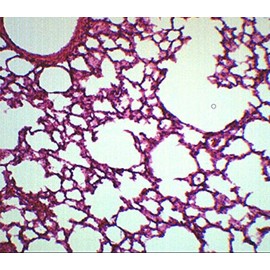 EISCO Lung Section, Prepared Microscope Slide - 75 x 25mm - Anatomy, Biology & Microscopy