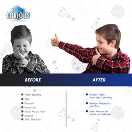 Lorious Moldable Mouthguard Custom Fit for Grinding Teeth & Clenching Night & Day Protection Pack of 6 in 2 Sizes for Kids & Small Mouths