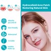 Pack of 330 Pimple Patch Hydrocolloid Plasters Invisible Natural Pimple
