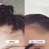 Bondi Boost Treatment Trio Bundle
