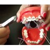 BELEON BELEON Braces Wire Orthodontic Dental Ligature Wire for Braces