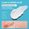 Butt Acne Clearing Treatment Cream: Clears & Prevents Breakouts Fast
