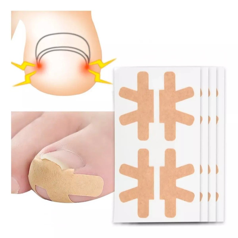 Veraly Pegatinas Correctoras De Uñas Enterradas Dolor 4 Plantillas