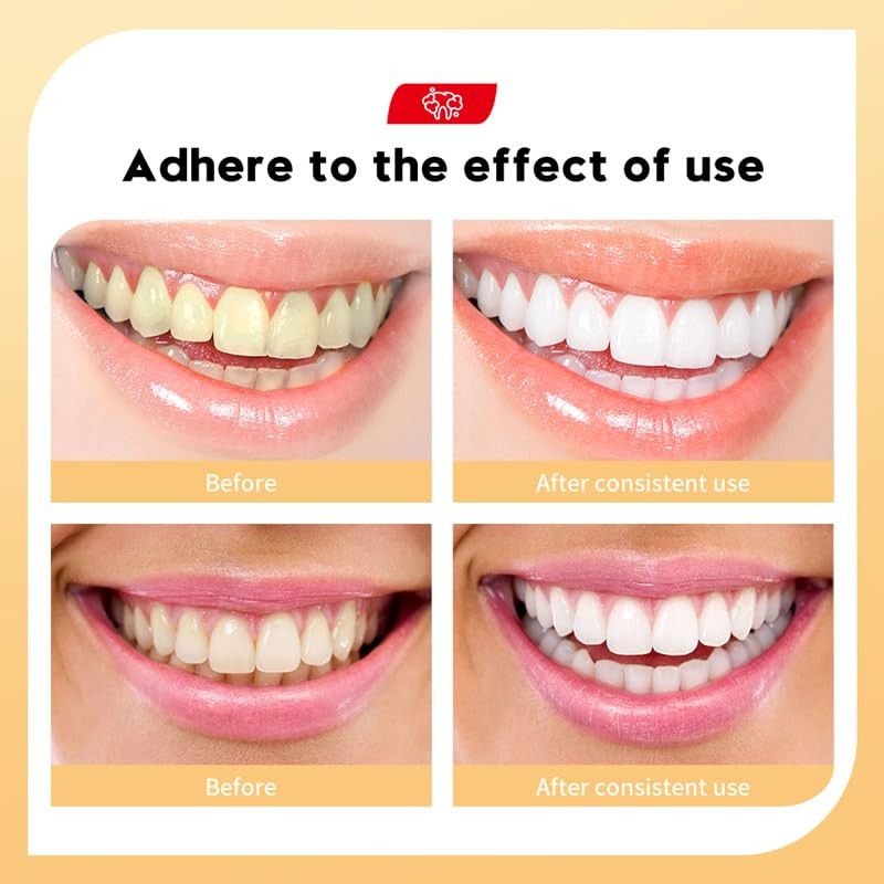 Coconut Mint Whitening Toothpaste, Natural Formula, Deep Cleaning, 100g