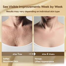 Crepey Skin Repair Treatment: Crepey Skin Repair Cream for Aging Skin with Pure Beef Tallow, Soluble Collagen & Apple Fruit - Advanced Crepe Fix Cream for Neck, Arms, Chest, Body - Unscented