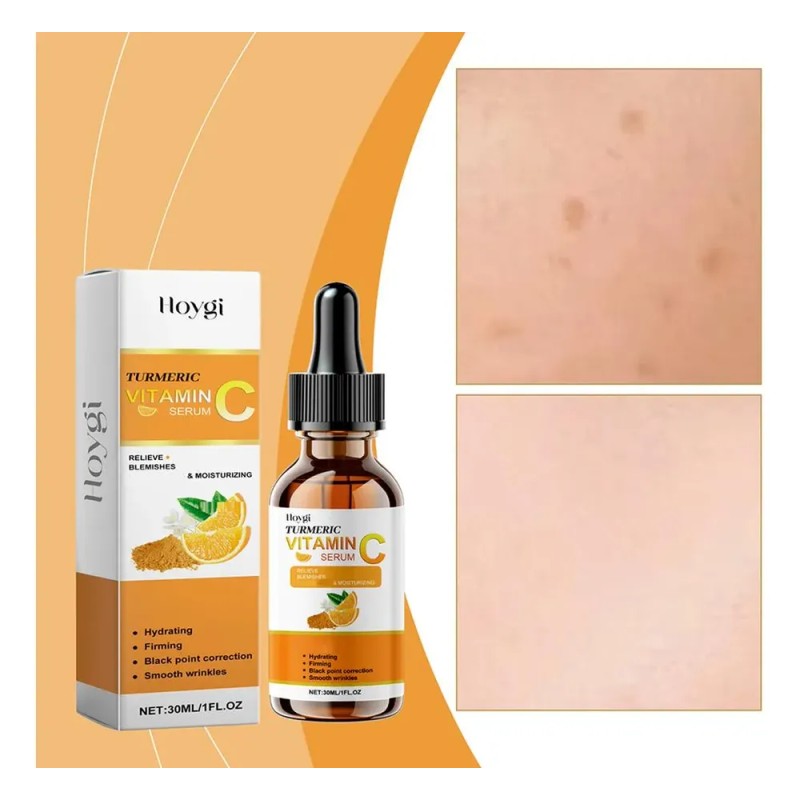 Sérum Líquido De Vitamina C Blanqueador Antienvejecimiento V