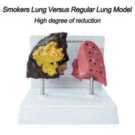 YANHAO Smokers Lung Model + Healthy Lung Model Life Size Human Lung Anatomy Model with Pathological Features and Accurate Anatomy Structure for Emonstrate The Effects of Smoking on Lung Health