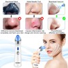 Senelux Blackhead Remover Vacuum Pore Cleaner Acne Comedone Extractor Face