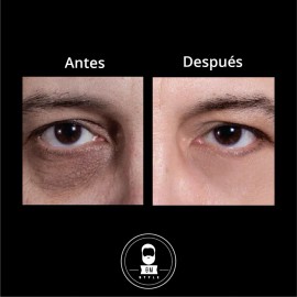 Kit Anti Ojeras Y Arrugas Roll On + Serum Antiedad Om Style