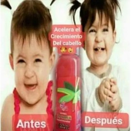 Shampoo Liquido, De Sandia Para El Cabello, Shelo Nabel.