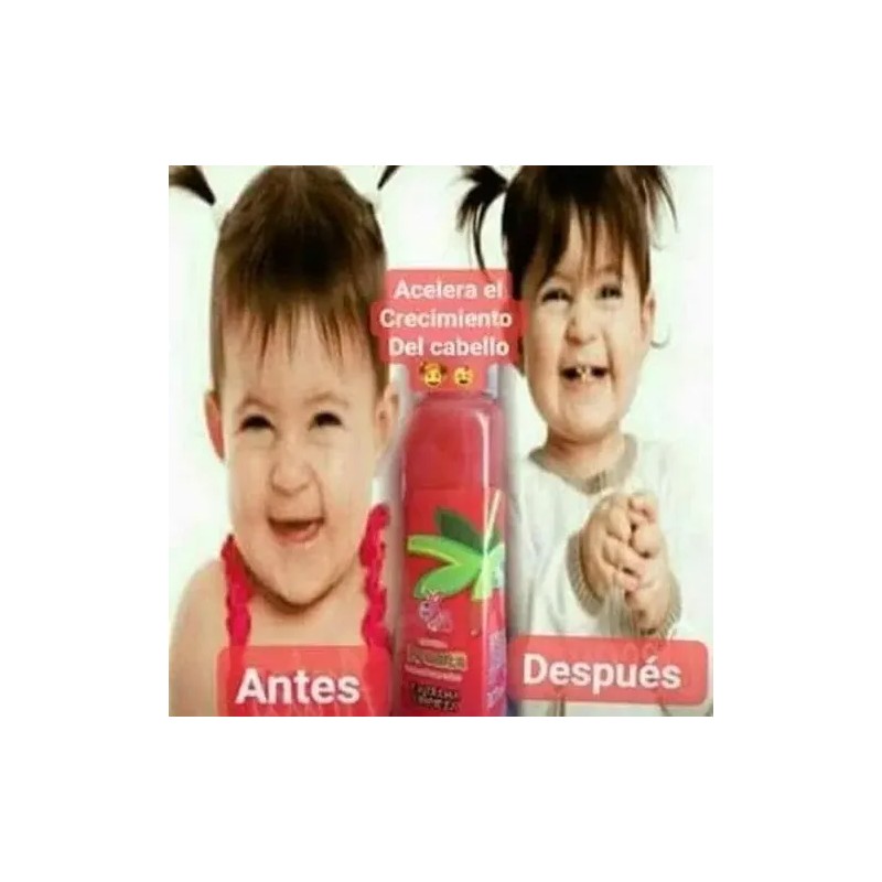 Shampoo Liquido, De Sandia Para El Cabello, Shelo Nabel.