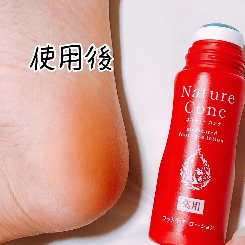 나리스 Nature Conc 풋 케어 로션/ 발 각질케어 Naris Nature