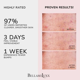 BellamiLuxx Butt Acne Clearing Treatment Cream: Body Acne Treatment for Folliculitis and Pimples on Buttocks, Thighs With 2% Salicylic Acid & Tea Tree Oil - Butt Cream for Smooth Skin