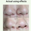 Face Nose Pores Shrinking Repairing Smoothing Blackhead Removal Liquid Essential