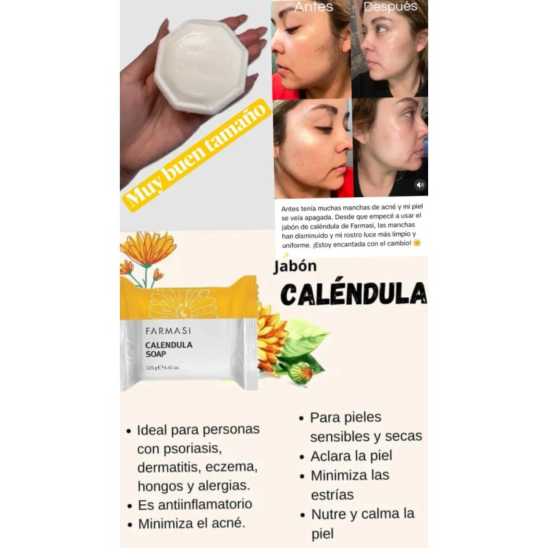 Set Pzas Calendula Crema Facial Tonico Jabón